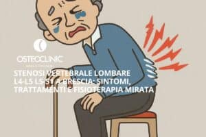 Illustrazione della stenosi del canale vertebrale lombare L4-L5 e L5-S1 in un uomo anziano a Brescia, che porta a compressione di radici nervose impedendo di camminare