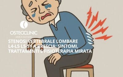 Stenosi lombare L4-L5 e L5-S1 a Brescia: Sintomi, Trattamenti e Fisioterapia Mirata